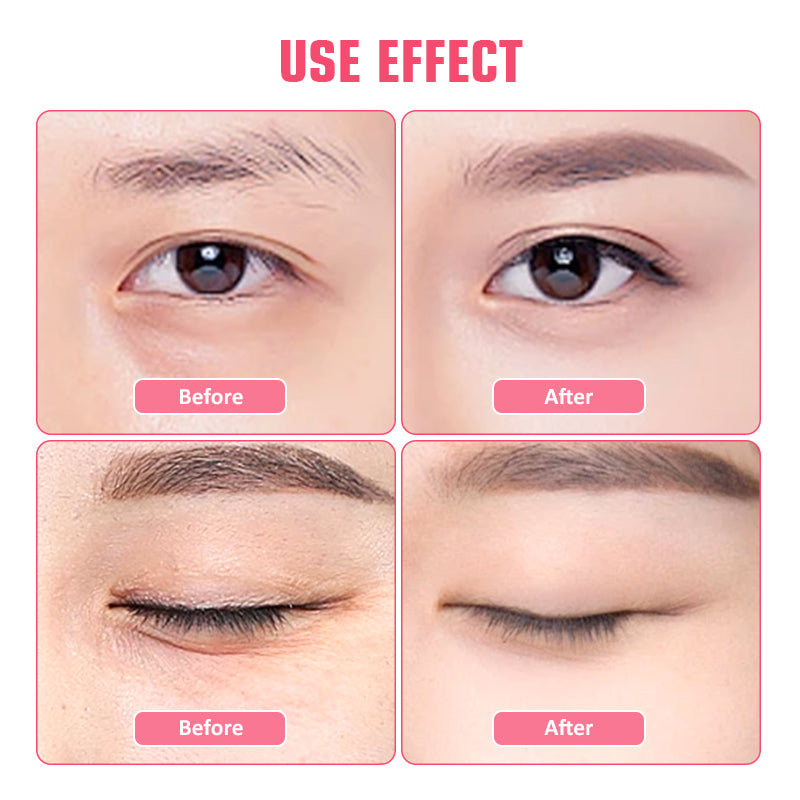 12-Pack Collagen Eye Mask ✨ Dark Circle Reduction & Overnight Hydration! 💎 Under Eye Patches for Fine Lines 🌟 Botox-Level #UnderEyeGlow #SkincareHack