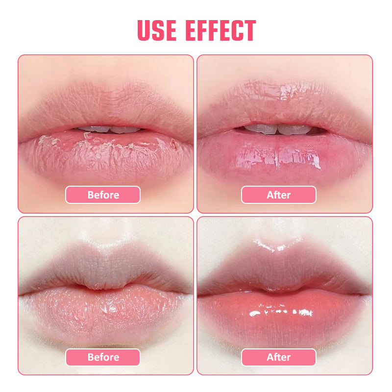 12-Pack Hydrating Collagen Lip Mask ✨ Overnight Repair & 24H Plump! 💋 Crystal Gel Patches for Lip Line Smoothing 🌟 Juicy #GlassSkinLips #LipCareHack