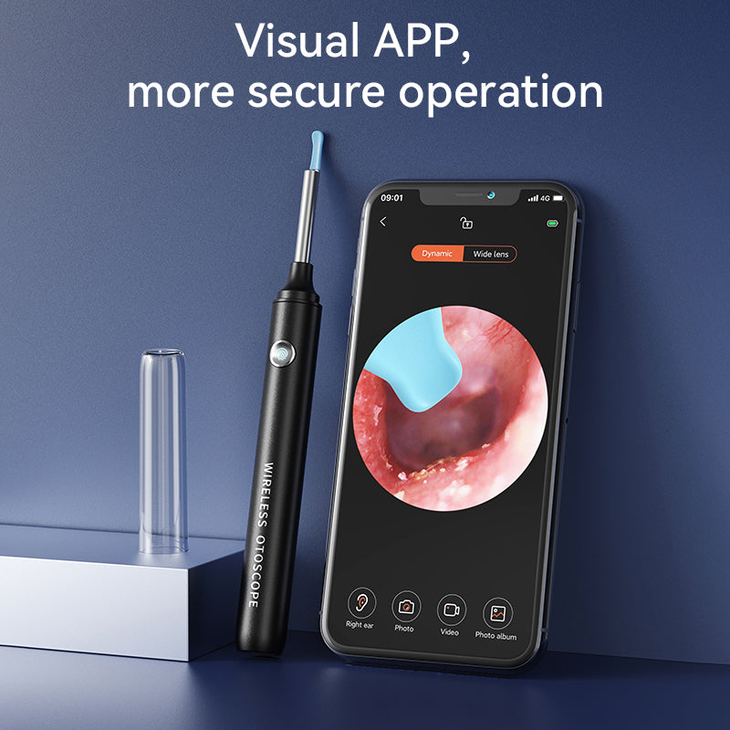 Pro-Grade Ear Cleaner with 1080P Camera ✨ Real-Time Ear Wax Removal for iPhone/Android 💡 Surgery-Level Visibility + Kid-Safe Scoop 🌟 #EarHack #OddlySatisfying