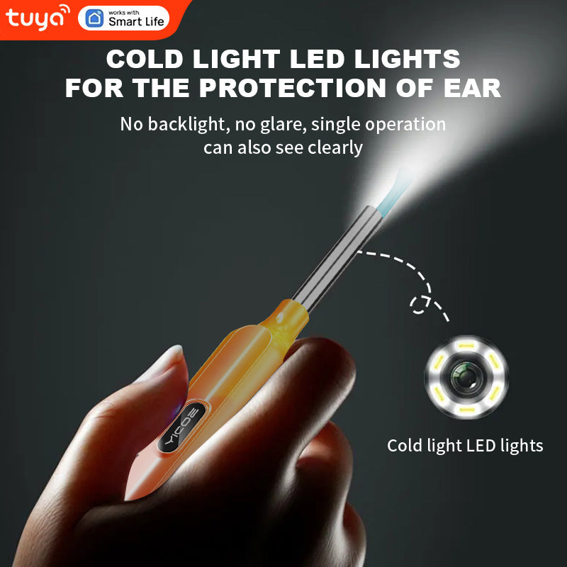 Tuya-Smart Ear Cleaner ✨ 1296P HD Camera + 6 LED Lights 💡 APP Control & Voice Commands 🌟 Real-Time Ear Rescue for iPhone/Android 🔥 #SmartHomeHacks #OddlySatisfying