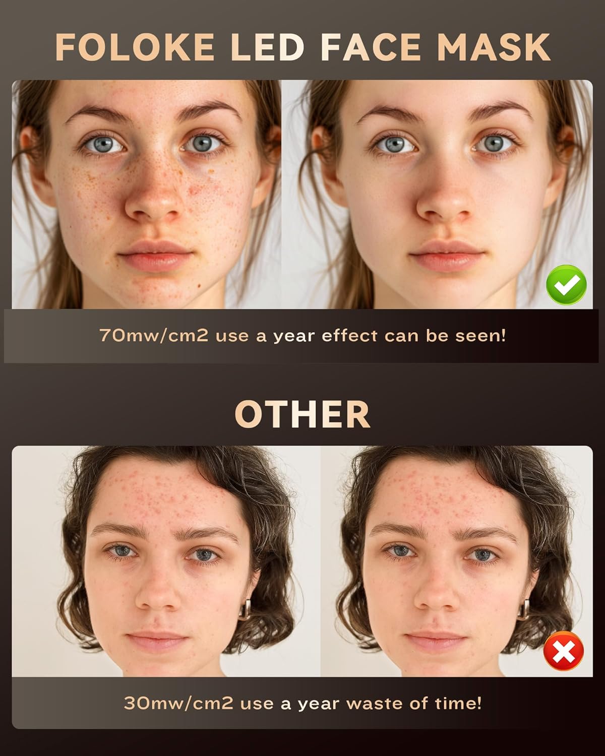Red Light Therapy Mask ✨ Dual-Wavelength Anti-Aging & Acne Killer 💎 630nm/830nm Salon-Level Glow at Home 🔥 Dermatologist-Tested #SkincareHack #RedLightMagic